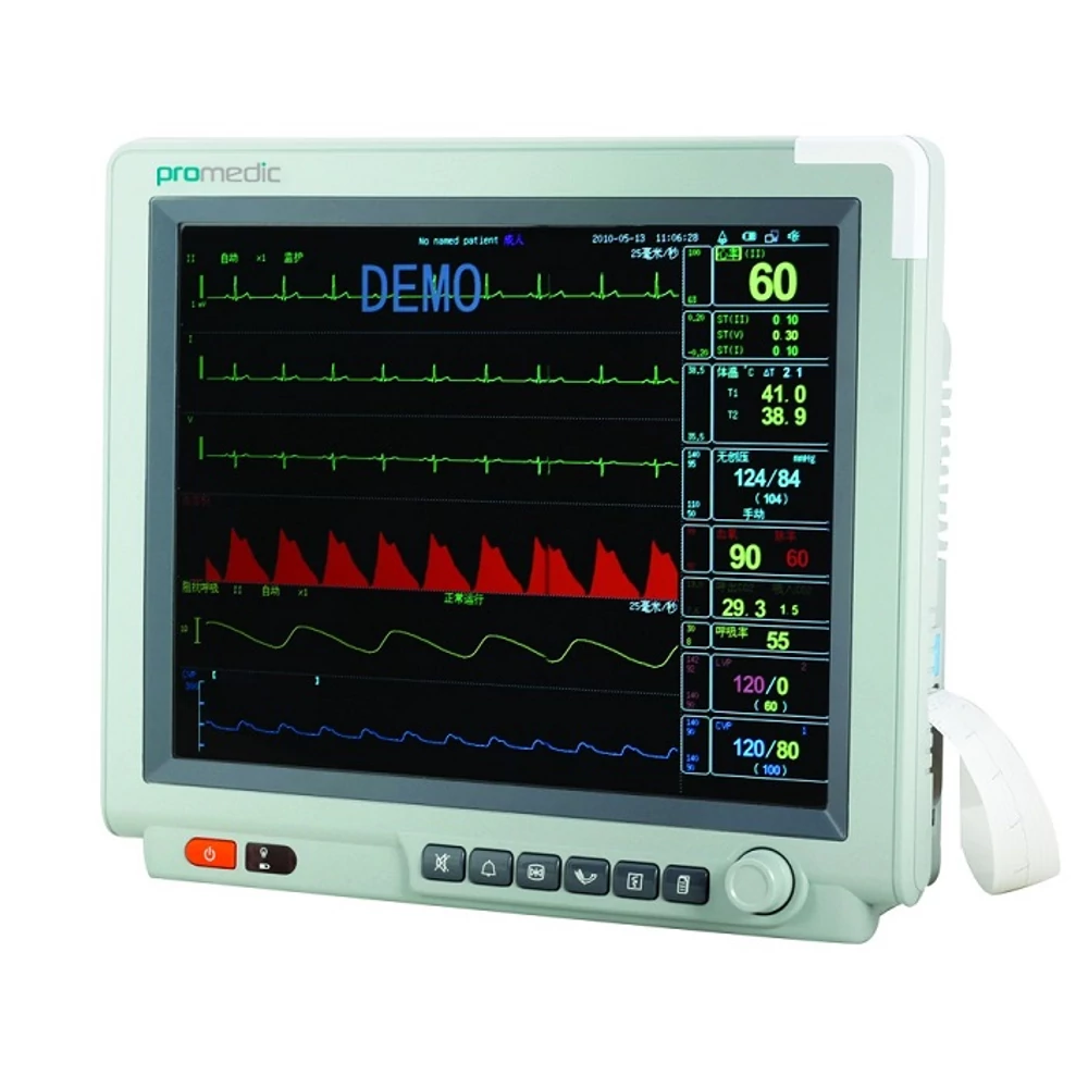Betegőrző monitor
